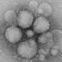 Health Officials: Risk of MERS Spreading to CA “Very Low”