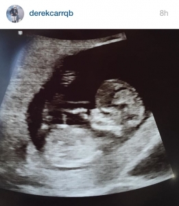 Baby Carr