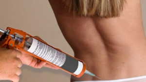BUTT IMPLANT